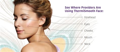 ThermiSmooth Face: Skin Tightening .